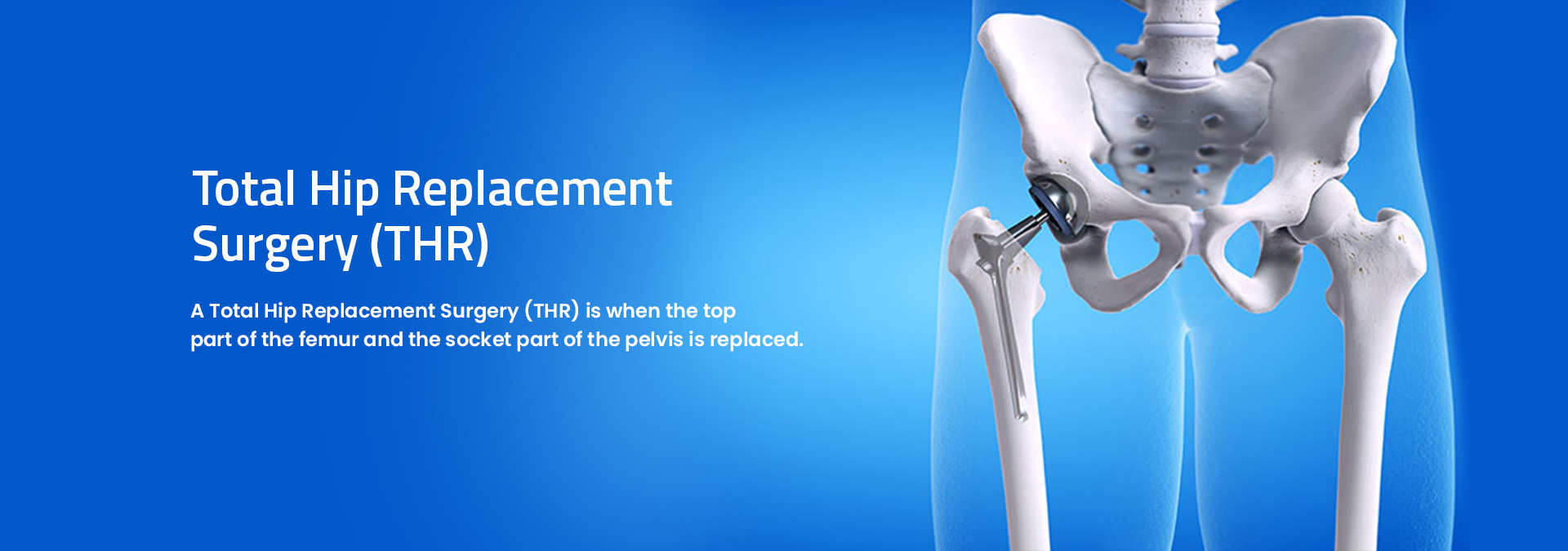 Joint Surgeon in Mumbai