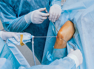 Dr. Mohit Shete Best Arthroscopic Surgeon in Mumbai & Thane